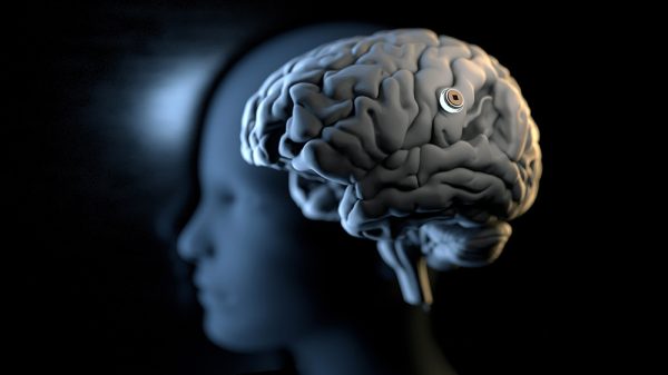 Merging Minds with Machines: Are Brain Chips the Next Frontier?
